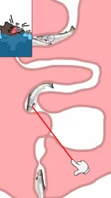Help Me: Tricky Story