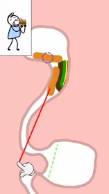 Help Me: Tricky Story